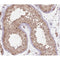 AF0141 at 1/200 staining human testis tissue sections by IHC-P. The tissue was formaldehyde fixed and a heat mediated antigen retrieval step in citrate buffer was performed. The tissue was then blocked and incubated with the antibody for 1.5 hours at 22¡ãC. An HRP conjugated goat anti-rabbit antibody was used as the secondary