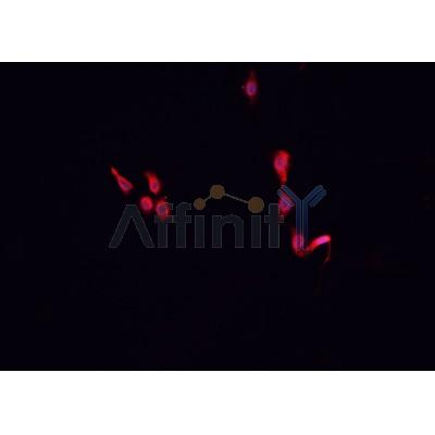 AF0141 staining MCF-7 cells by IF/ICC. The sample were fixed with PFA and permeabilized in 0.1% Triton X-100,then blocked in 10% serum for 45 minutes at 25¡ãC. The primary antibody was diluted at 1/200 and incubated with the sample for 1 hour at 37¡ãC. An  Alexa Fluor 594 conjugated goat anti-rabbit IgG (H+L) antibody(Cat.