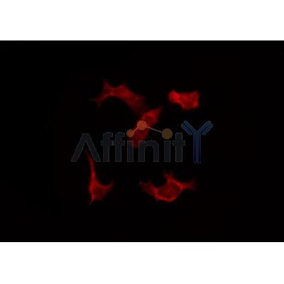AF0141 staining LOVO by IF/ICC. The sample were fixed with PFA and permeabilized in 0.1% Triton X-100,then blocked in 10% serum for 45 minutes at 25¡ãC. The primary antibody was diluted at 1/200 and incubated with the sample for 1 hour at 37¡ãC. An  Alexa Fluor 594 conjugated goat anti-rabbit IgG (H+L) Ab, diluted at 1/600, was used as the secondary antibod