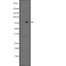 Western blot analysis of extracts from B16F10, using NUFIP2 Antibody. The lane on the left was treated with blocking peptide.