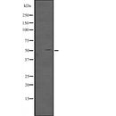 Western blot analysis of extracts from Mouse brain, using TFAP2D Antibody. The lane on the left was treated with blocking peptide.