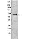 Western blot analysis of ZSCAN2 expression in HEK293 cells ,The lane on the left is treated with the antigen-specific peptide.