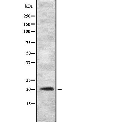 Western blot analysis of GKN2 expression in HEK293 cells ,The lane on the left is treated with the antigen-specific peptide.