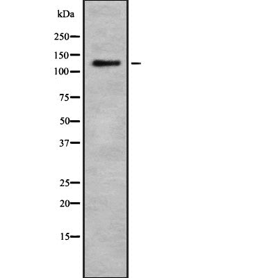Western blot analysis of RB6I2 expression in HEK293 cells ,The lane on the left is treated with the antigen-specific peptide.