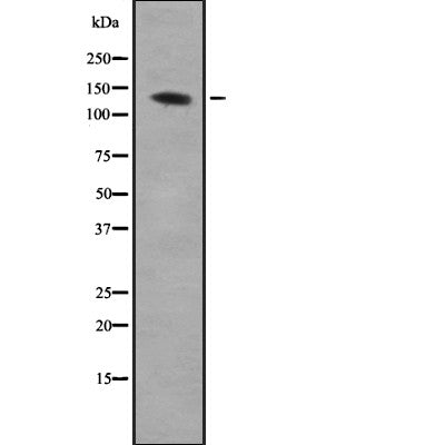 Western blot analysis of AEBP1 expression in HEK293 cells ,The lane on the left is treated with the antigen-specific peptide.