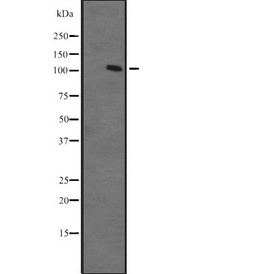 Western blot analysis of ZFPM1 expression in Ant fetal muscle lysate ;,The lane on the left is treated with the antigen-specific peptide.
