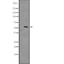 Western blot analysis of HOMEZ expression in  Human placenta lysate ,The lane on the left is treated with the antigen-specific peptide.