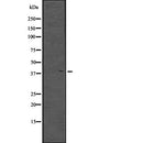 Western blot analysis of MKX expression in  NCI-H460 cell line lysate ;,The lane on the left is treated with the antigen-specific peptide.