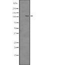 Western blot analysis of SRRM1 expression in HEK293 cells ,The lane on the left is treated with the antigen-specific peptide.