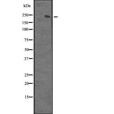 Western blot analysis of XRN1 expression in  Hela cell lysate,The lane on the left is treated with the antigen-specific peptide.