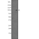 Western blot analysis of extracts from MCF7, using MYOCD Antibody. Lane 1 was treated with the blocking peptide.