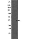 DF2435 at 1/100 staining Rat brain tissue by IHC-P. The sample was formaldehyde fixed and a heat mediated antigen retrieval step in citrate buffer was performed. The sample was then blocked and incubated with the antibody for 1.5 hours at 22¡ãC. An HRP conjugated goat anti-rabbit antibody was used as the secondary