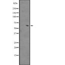 DF2436 at 1/100 staining Human kidney tissue by IHC-P. The sample was formaldehyde fixed and a heat mediated antigen retrieval step in citrate buffer was performed. The sample was then blocked and incubated with the antibody for 1.5 hours at 22¡ãC. An HRP conjugated goat anti-rabbit antibody was used as the secondary