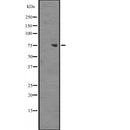 DF2437 at 1/100 staining Human liver tissue by IHC-P. The sample was formaldehyde fixed and a heat mediated antigen retrieval step in citrate buffer was performed. The sample was then blocked and incubated with the antibody for 1.5 hours at 22¡ãC. An HRP conjugated goat anti-rabbit antibody was used as the secondary