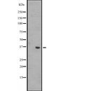 Western blot analysis of WNT8B expression in A431 whole cell lysate ,The lane on the left is treated with the antigen-specific peptide.