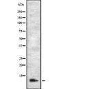 DF2442 at 1/100 staining Rat kidney tissue by IHC-P. The sample was formaldehyde fixed and a heat mediated antigen retrieval step in citrate buffer was performed. The sample was then blocked and incubated with the antibody for 1.5 hours at 22¡ãC. An HRP conjugated goat anti-rabbit antibody was used as the secondary