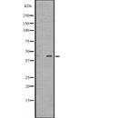 Western blot analysis of DMRTB1 expression in  Jurkat cell lysate.;,The lane on the left is treated with the antigen-specific peptide.