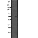 Western blot analysis of BTBD14B expression in HEK293 cells ,The lane on the left is treated with the antigen-specific peptide.