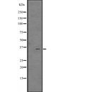 Western blot analysis of CITED4 expression in  MCF7 Cell Lysate ,The lane on the left is treated with the antigen-specific peptide.