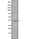 Western blot analysis of ROAA expression in HEK293 cells ,The lane on the left is treated with the antigen-specific peptide.