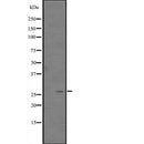 Western blot analysis of CITED2 expression in  Hela cell lysate,The lane on the left is treated with the antigen-specific peptide.