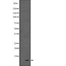 DF2456 at 1/100 staining Mouse muscle tissue by IHC-P. The sample was formaldehyde fixed and a heat mediated antigen retrieval step in citrate buffer was performed. The sample was then blocked and incubated with the antibody for 1.5 hours at 22¡ãC. An HRP conjugated goat anti-rabbit antibody was used as the secondary
