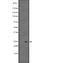 Western blot analysis of DUSP26 expression in  Hela cell lysate,The lane on the left is treated with the antigen-specific peptide.