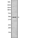 DF2463 at 1/100 staining Human gastric tissue by IHC-P. The sample was formaldehyde fixed and a heat mediated antigen retrieval step in citrate buffer was performed. The sample was then blocked and incubated with the antibody for 1.5 hours at 22¡ãC. An HRP conjugated goat anti-rabbit antibody was used as the secondary