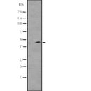 Western blot analysis of WWTR1 expression in  Hela cell lysate,The lane on the left is treated with the antigen-specific peptide.