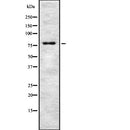 Western blot analysis of TSYL2 expression in HEK293 cells ,The lane on the left is treated with the antigen-specific peptide.