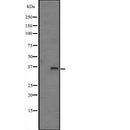 Western blot analysis of extracts from Mouse spleen, using FN3K Antibody. The lane on the left was treated with blocking peptide.