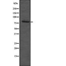 Western blot analysis of RBM35B expression in  Hela cell lysate,The lane on the left is treated with the antigen-specific peptide.