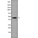 DF2470 at 1/100 staining Human spleen tissue by IHC-P. The sample was formaldehyde fixed and a heat mediated antigen retrieval step in citrate buffer was performed. The sample was then blocked and incubated with the antibody for 1.5 hours at 22¡ãC. An HRP conjugated goat anti-rabbit antibody was used as the secondary