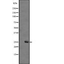 Western blot analysis of MOBKL1B expression in A431 whole cell lysate ,The lane on the left is treated with the antigen-specific peptide.