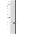 Western blot analysis of MED20 expression in  RPMI-8226 cell lysate ,The lane on the left is treated with the antigen-specific peptide.