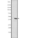 DF2473 at 1/100 staining Human breast cancer tissue by IHC-P. The sample was formaldehyde fixed and a heat mediated antigen retrieval step in citrate buffer was performed. The sample was then blocked and incubated with the antibody for 1.5 hours at 22¡ãC. An HRP conjugated goat anti-rabbit antibody was used as the secondary