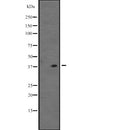 Western blot analysis of VSX1 expression in  K562 cell line lysate ;,The lane on the left is treated with the antigen-specific peptide.