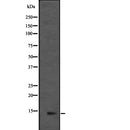 Western blot analysis of extracts from Mouse heart, using L36mt Antibody. Lane 1 was treated with the blocking peptide.