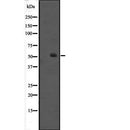 Western blot analysis of HNF-6 expression in Jurkat cell lysate,The lane on the left is treated with the antigen-specific peptide.