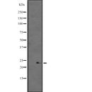 Western blot analysis of TrpRS expression in WARS2 transfected 293T cell lysate,The lane on the left is treated with the antigen-specific peptide.