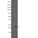 Western blot analysis of HSPB8 expression in  Rat skeletal muscle lysate;,The lane on the left is treated with the antigen-specific peptide.