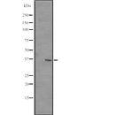 Western blot analysis of RRP7 expression in  MCF7 cell lysate ,The lane on the left is treated with the antigen-specific peptide.