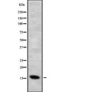 DF2488 at 1/100 staining Human gastric tissue by IHC-P. The sample was formaldehyde fixed and a heat mediated antigen retrieval step in citrate buffer was performed. The sample was then blocked and incubated with the antibody for 1.5 hours at 22¡ãC. An HRP conjugated goat anti-rabbit antibody was used as the secondary