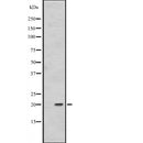 DF2492 at 1/100 staining Mouse liver tissue by IHC-P. The sample was formaldehyde fixed and a heat mediated antigen retrieval step in citrate buffer was performed. The sample was then blocked and incubated with the antibody for 1.5 hours at 22¡ãC. An HRP conjugated goat anti-rabbit antibody was used as the secondary
