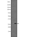 Western blot analysis of FGF12 expression in  Mouse brain lysate ,The lane on the left is treated with the antigen-specific peptide.
