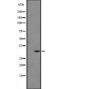 Western blot analysis of FGF5 expression in  Human placenta tissue lysate (in RIPA buffer) ;,The lane on the left is treated with the antigen-specific peptide.