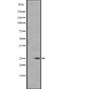 Western blot analysis of FGF8 expression in  Jurkat cell lysate in RIPA buffer ,The lane on the left is treated with the antigen-specific peptide.