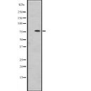 Western blot analysis of HSPA12B expression in  SiHa cell line lysates ,The lane on the left is treated with the antigen-specific peptide.
