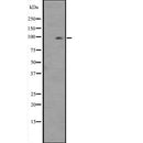 Western blot analysis of HSPA4L expression in  COLO205 cell lysate ,The lane on the left is treated with the antigen-specific peptide.