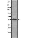 DF2504 at 1/100 staining Human uterus tissue by IHC-P. The sample was formaldehyde fixed and a heat mediated antigen retrieval step in citrate buffer was performed. The sample was then blocked and incubated with the antibody for 1.5 hours at 22¡ãC. An HRP conjugated goat anti-rabbit antibody was used as the secondary